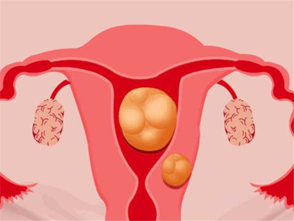 左侧子宫动脉血反向影响胚胎着床吗？