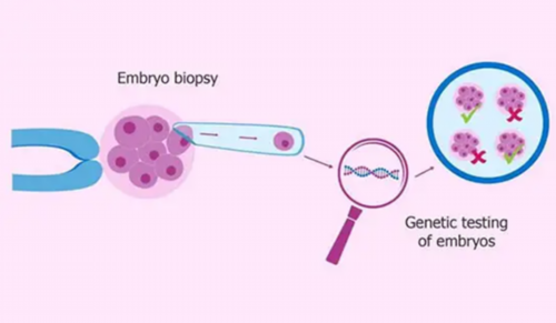 大龄试管婴儿，【羊水穿刺多久出结果】羊水穿刺多久出结果