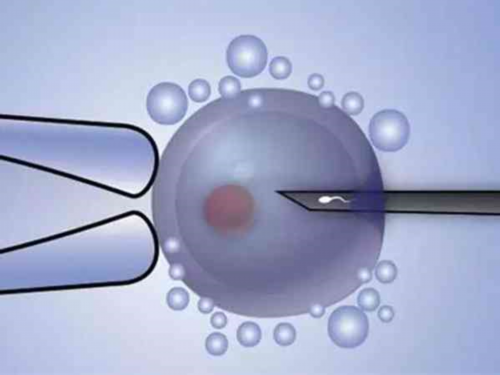 35岁|试管中|移植前吃这个感觉难受