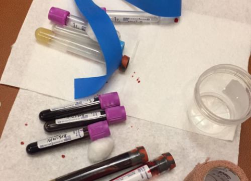 <b>怎么看监测排卵b超单和试管促排b超单？</b>