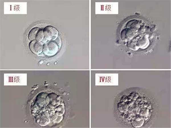 胚胎碎片多但着床成功了，对孩子健康会有影响吗？